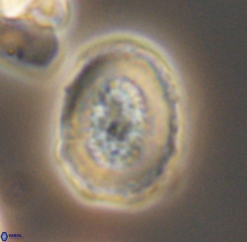 Miravetesina culverensis 6492