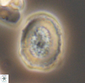 Miravetesina culverensis 6492