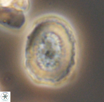 Miravetesina culverensis 6493