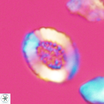 Miravetesina culverensis 6407