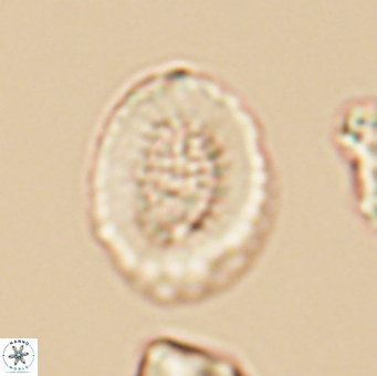Miravetesina culverensis 6412