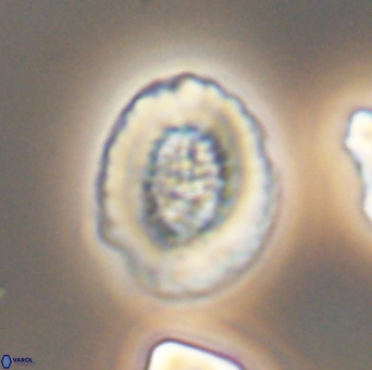 Miravetesina culverensis 6413