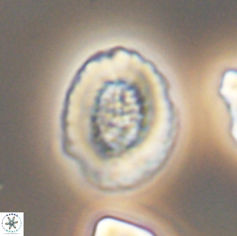 Miravetesina culverensis 6413