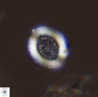 Miravetesina bergenii 42218