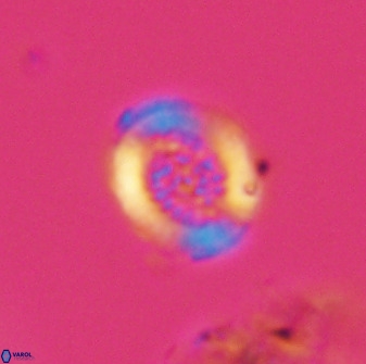 Miravetesina bergenii 42219