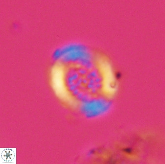 Miravetesina bergenii 42219