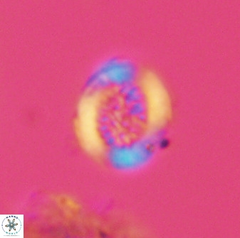Miravetesina bergenii 42221