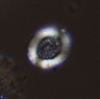 Miravetesina bergenii 42222