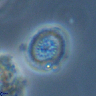 Miravetesina bergenii 42225