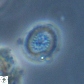 Miravetesina bergenii 42225