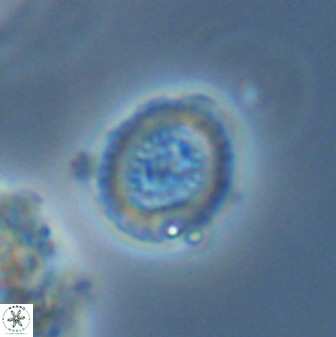Miravetesina bergenii 42226