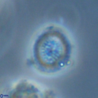 Miravetesina bergenii 42227