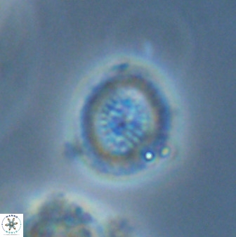 Miravetesina bergenii 42227