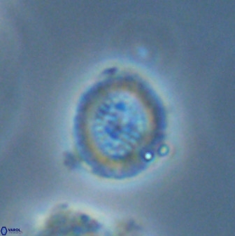 Miravetesina bergenii 42228