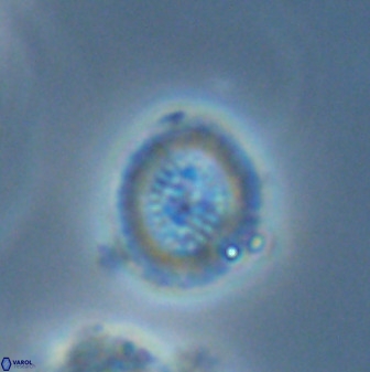 Miravetesina bergenii 42229