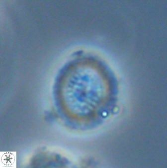 Miravetesina bergenii 42229