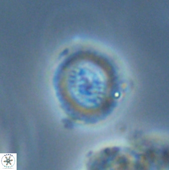Miravetesina bergenii 42230