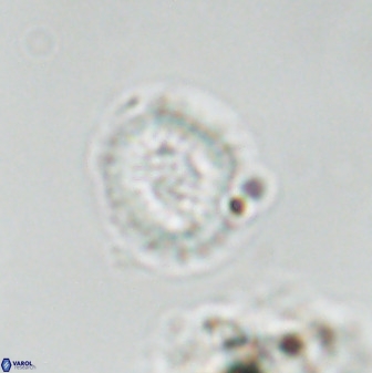 Miravetesina bergenii 42232