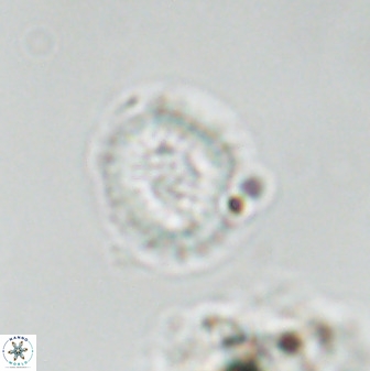Miravetesina bergenii 42232
