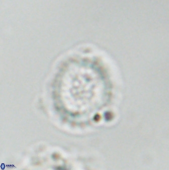 Miravetesina bergenii 42235