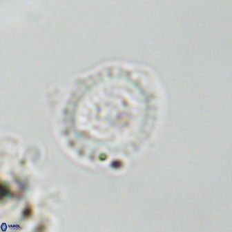 Miravetesina bergenii 42236