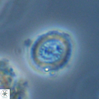 Miravetesina bergenii 42237