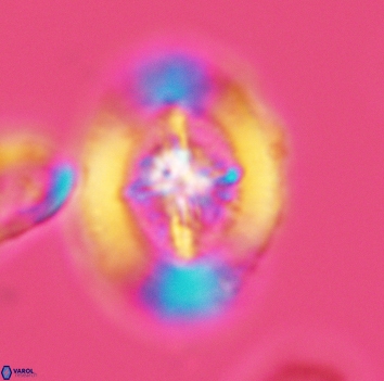 Miravetesina favula 3673