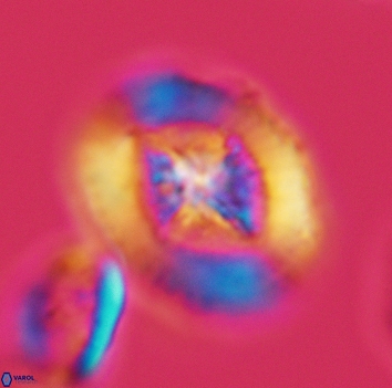 Miravetesina favula 3674