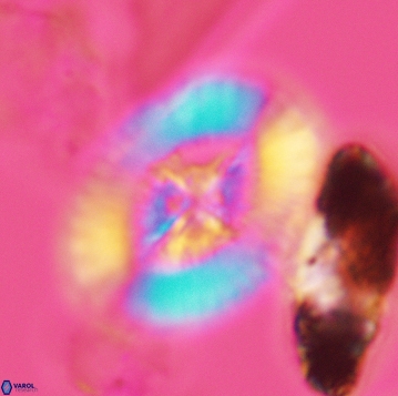 Miravetesina favula 3742