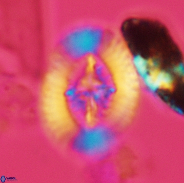 Miravetesina favula 3743