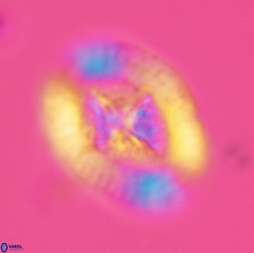 Miravetesina favula 3756