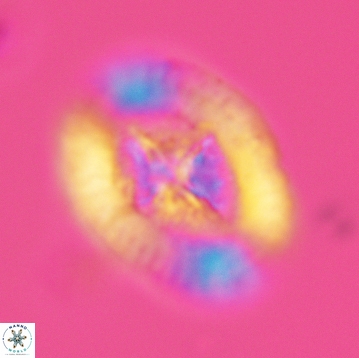 Miravetesina favula 3756