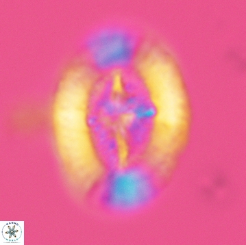 Miravetesina favula 3757