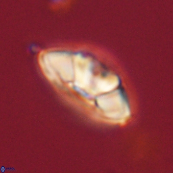 Mulleria tuzuniorum 62062