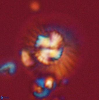 Mulleria tuzuniorum 62083