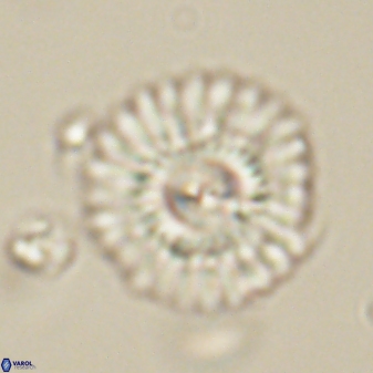 Mulleria tuzuniorum 62094