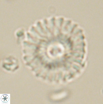 Mulleria tuzuniorum 62093