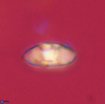 Mulleria tuzuniorum 62977