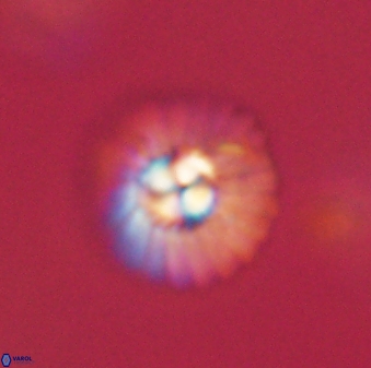 Mulleria tuzuniorum 62989