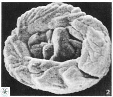 Neocrepidolithus biskayae 21065