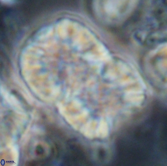 Nannoconus multicadus 15400