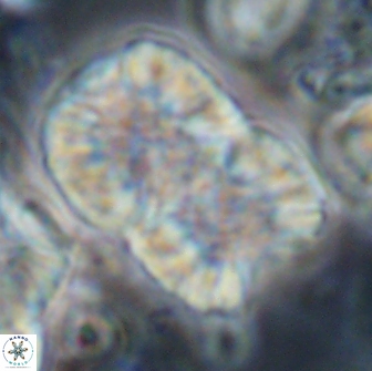 Nannoconus multicadus 15400