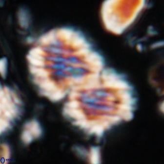 Nannoconus multicadus 15385