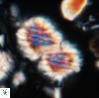 Nannoconus multicadus 15385