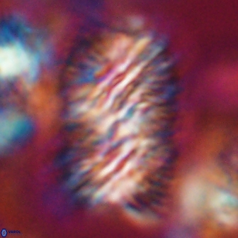 Nannoconus multicadus 15391