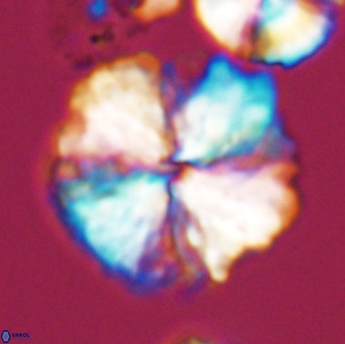 Nannoconus magnadiscus 11471