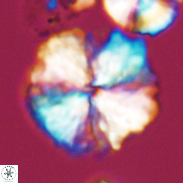 Nannoconus magnadiscus 11471