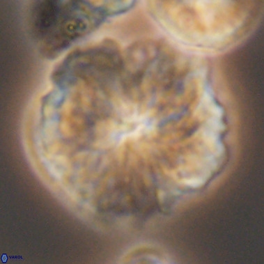 Nannoconus magnadiscus 11473