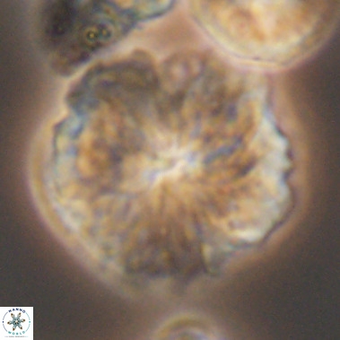Nannoconus magnadiscus 11473