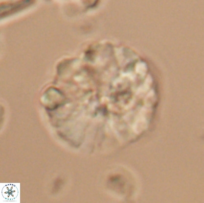Nannoconus magnadiscus 26247